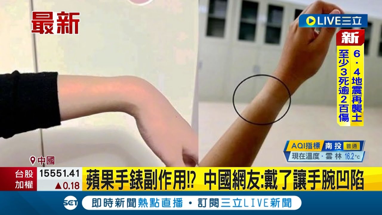 蘋果手錶副作用? 中國網友戴蘋果手錶出現