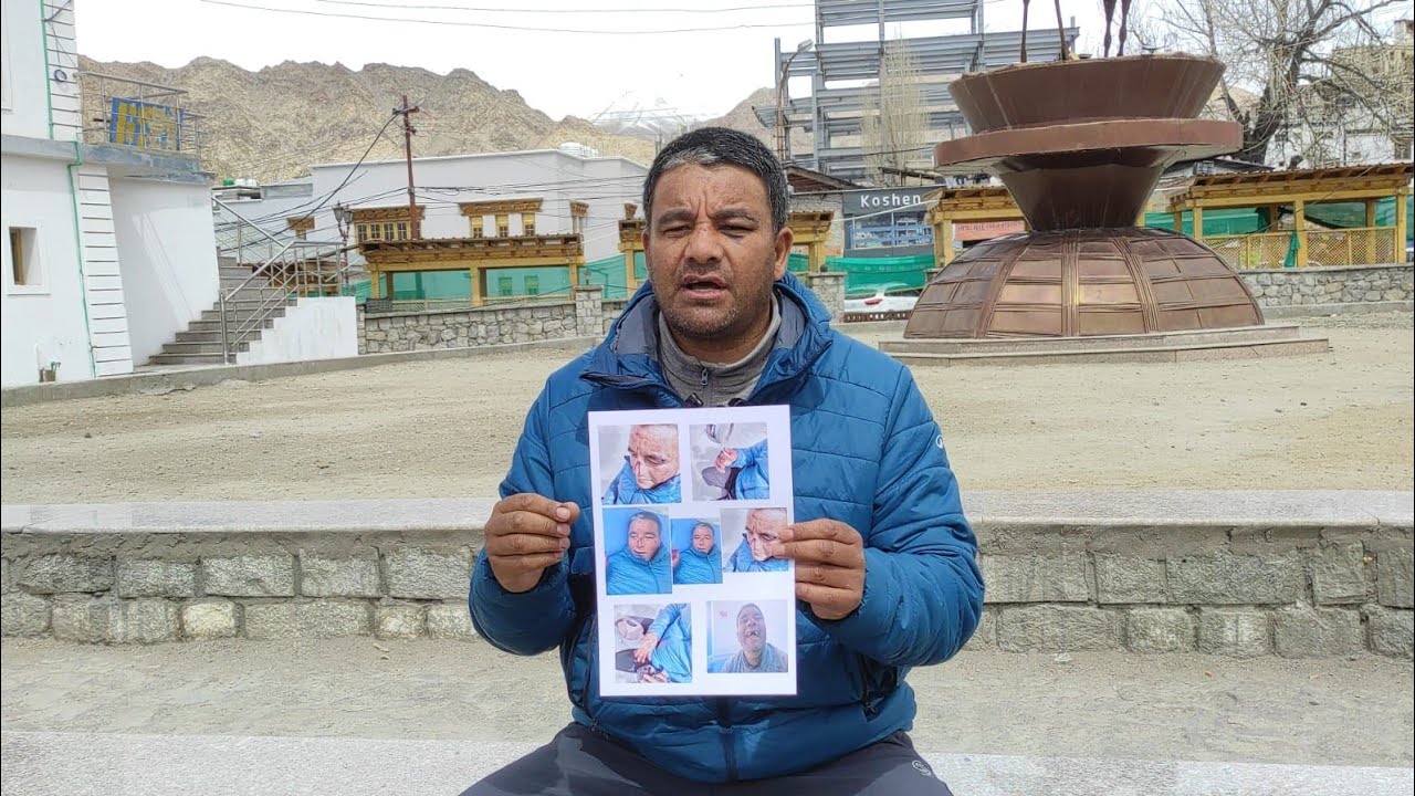 Man Injured in Alleged Assault Over Land Dispute in Nubra, Seeks Police Action