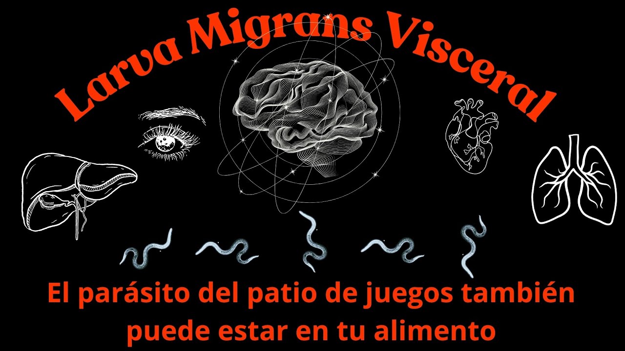 Larva Migrans Visceral - Toxocariasis humana. Zoonosis transmitida x alimento y en parques de juegos