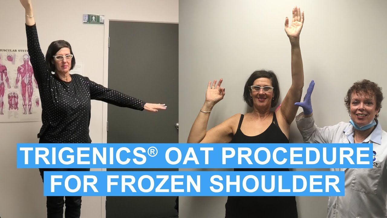 FROZEN SHOULDER CURE: Brisbane Woman Thought She Had Bursitis
