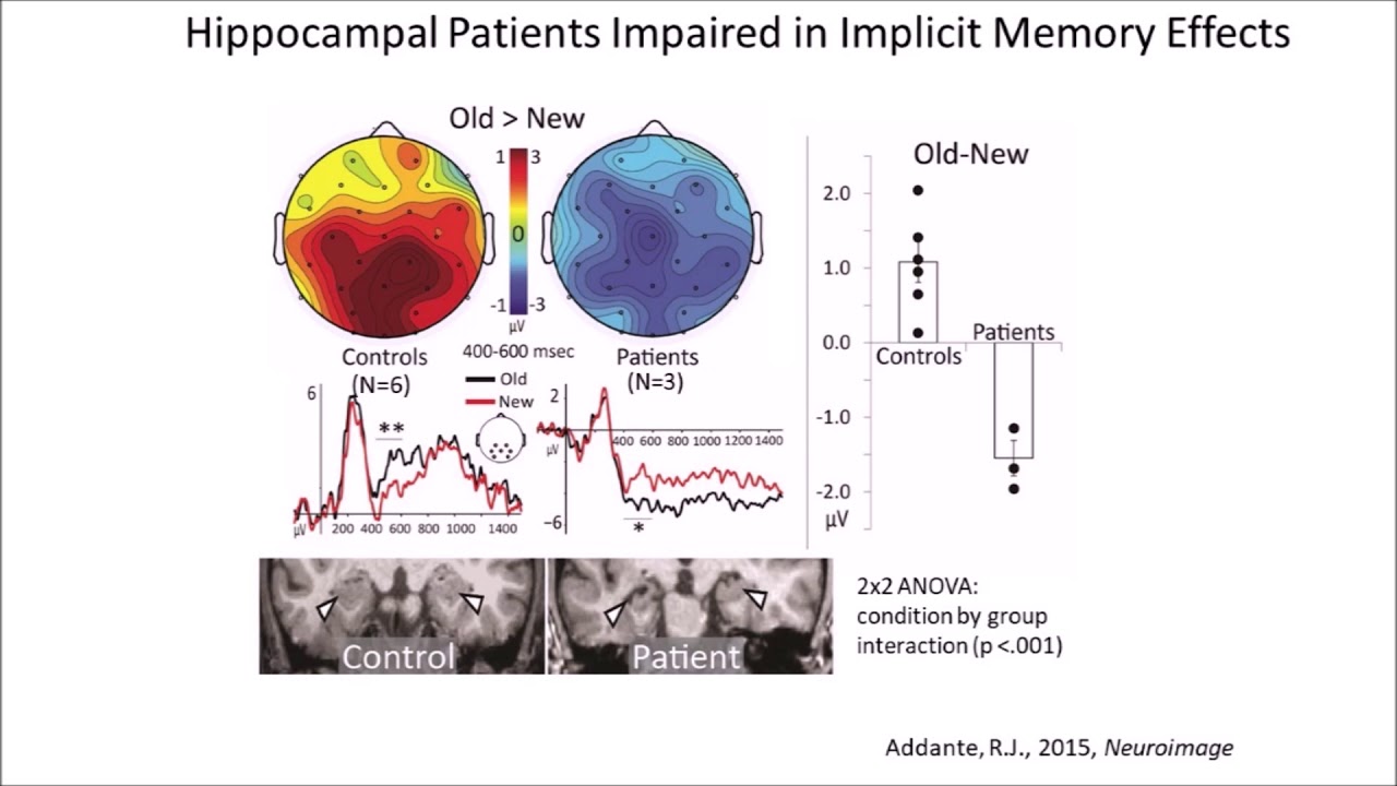 Neuroscience of Memory and Brain States UC Davis 2018 section