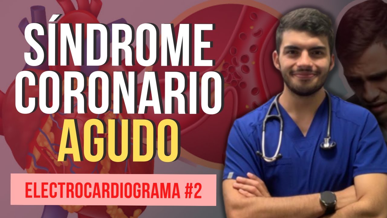 SÍNDROME CORONARIO AGUDO - Electrocardiograma II (Parte 5)