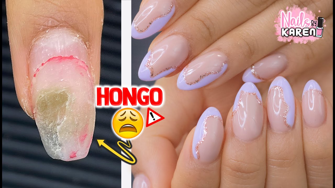 CLIENTA LLEGA con HONGO en UÑAS - Se asusto Part.1 | NailsByKaren