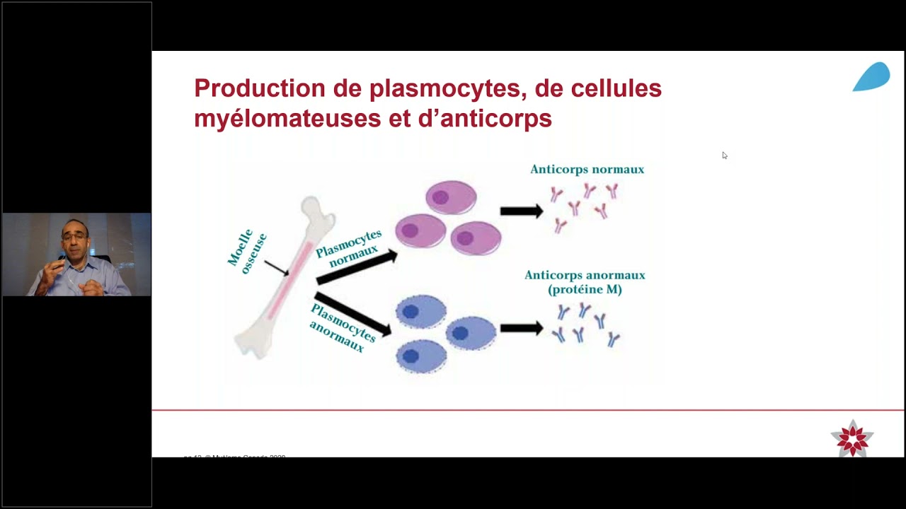Myélome multiple 101   du diagnostic aux traitements