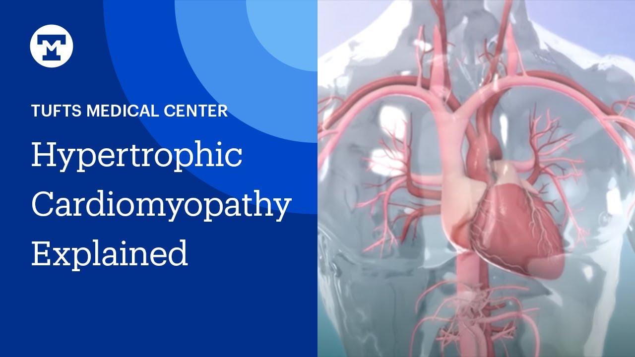 Hypertrophic Cardiomyopathy (HCM) Explained | Tufts Medical Center