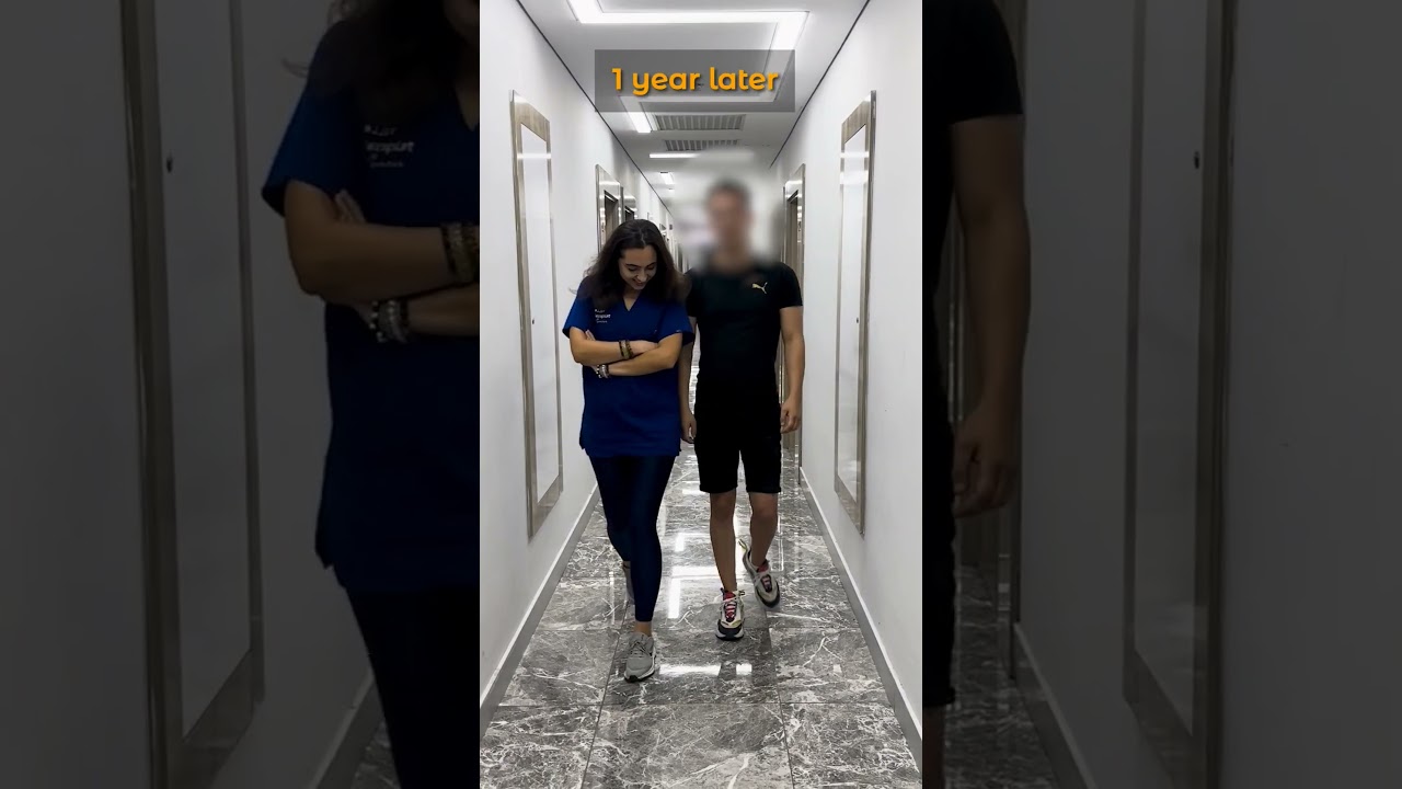 From 170 cm to 178 cm: Leg Lengthening Surgery Recovery Update