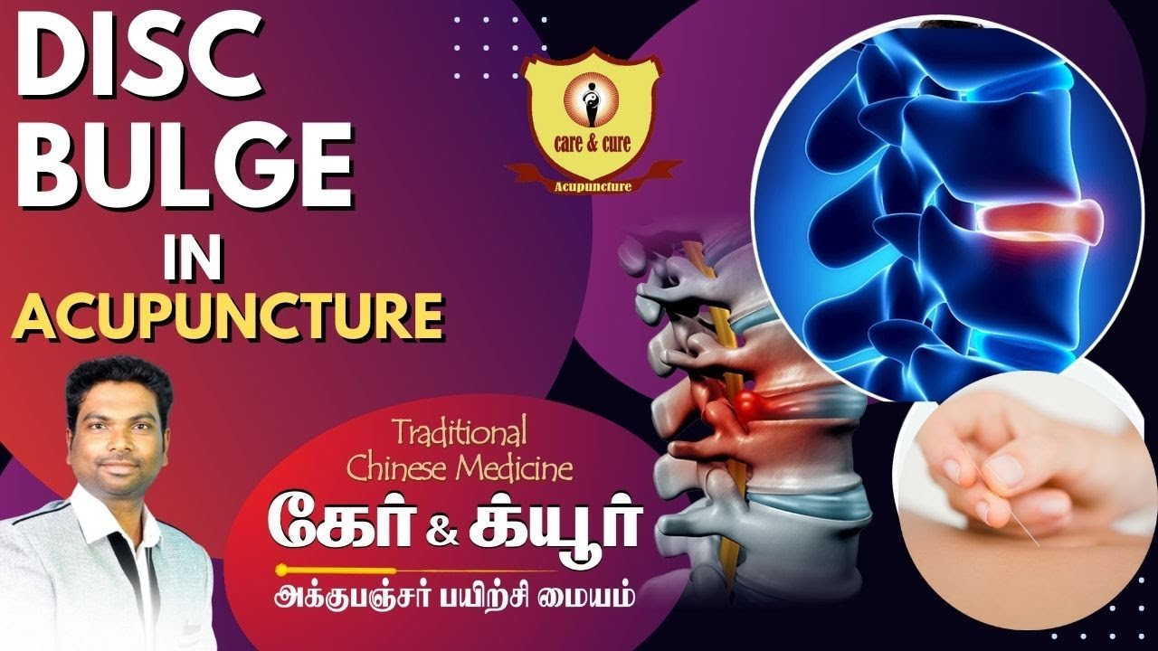 DISC BULGE IN ACUPUNCTURE | TCM ACUPUNCTURE | SPINE SPECIALITY SPINE CAREIN ACUPINCTURE
