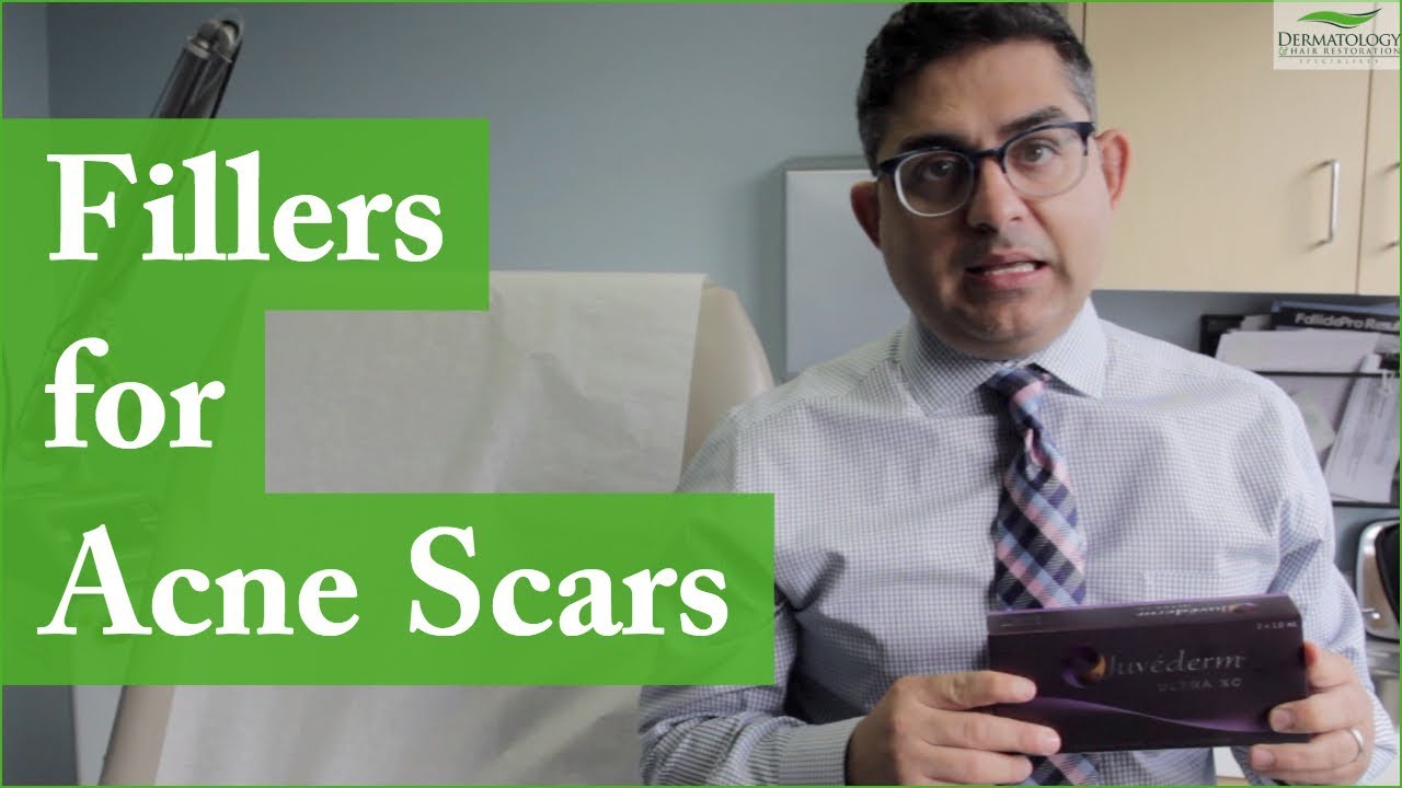 Filler for Acne Scars - Los Angeles