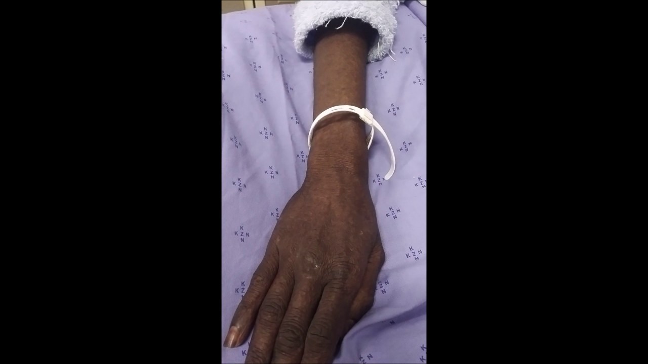 Treatment Denied
