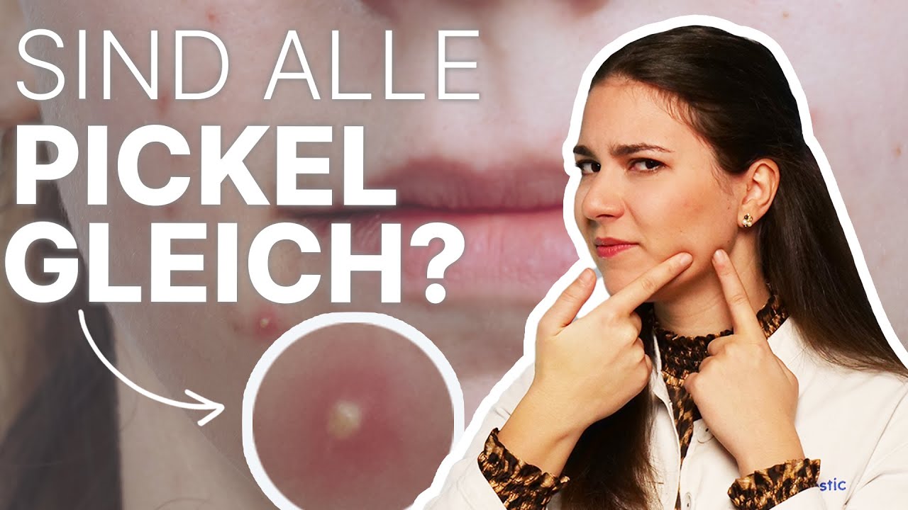 Pickelarten - Unterirdische Pickel, was steckt dahinter? 🤔 Haut&auml;rztin erkl&auml;rt!
