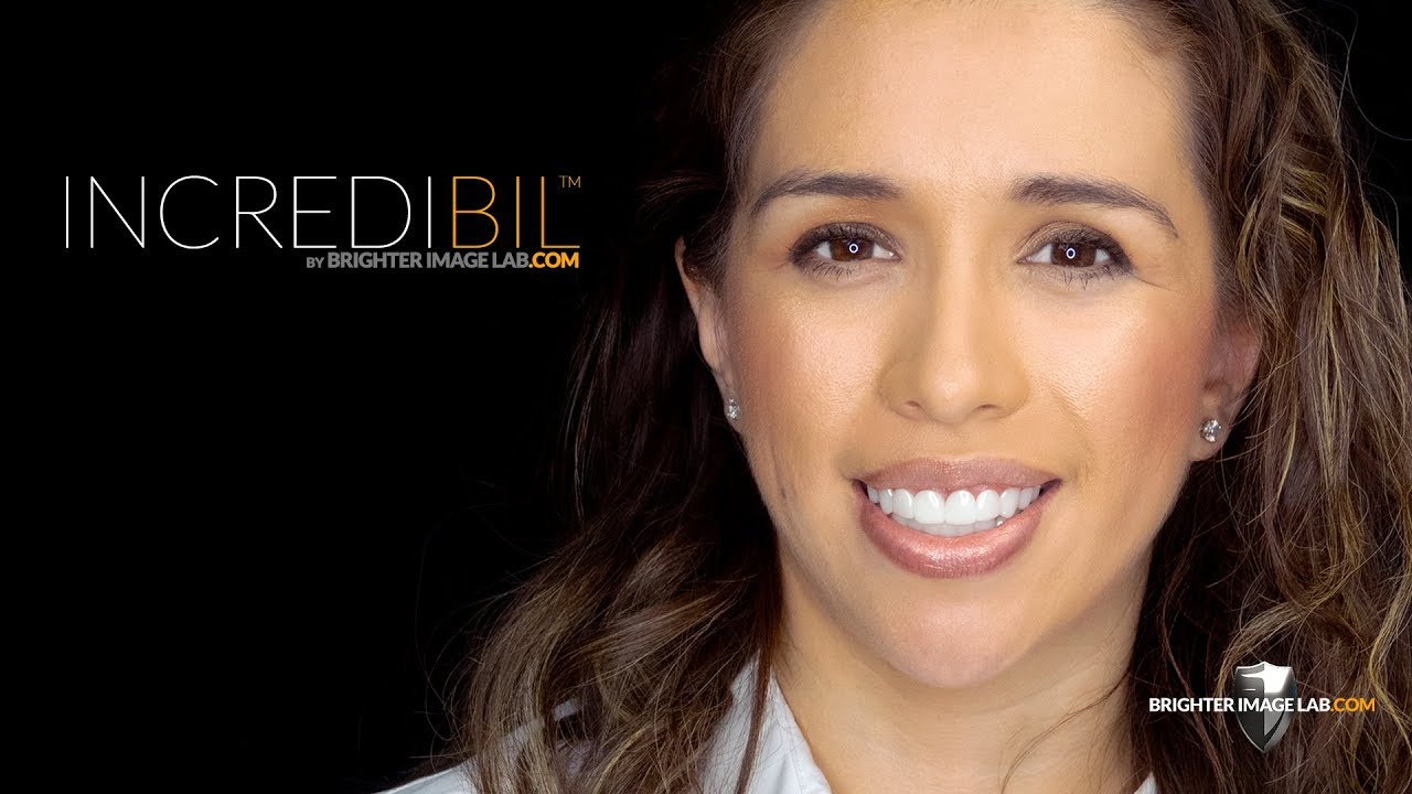 Press-On Veneers ™ - Сравнение и обзор Incredibil ™ от Brighter Image Lab!