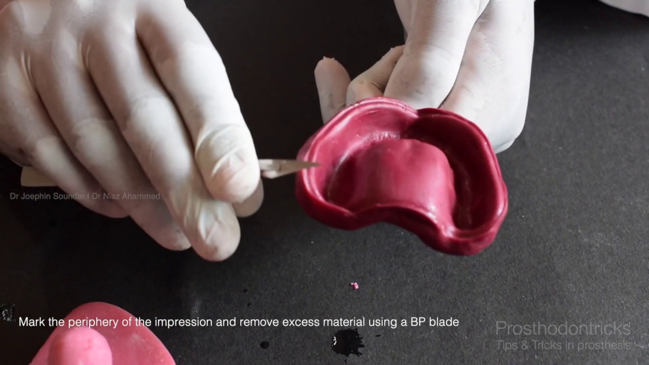 Preclinical Prosthodontics : Maxillary Edentulous Arch Impression Making - Impression Compound.