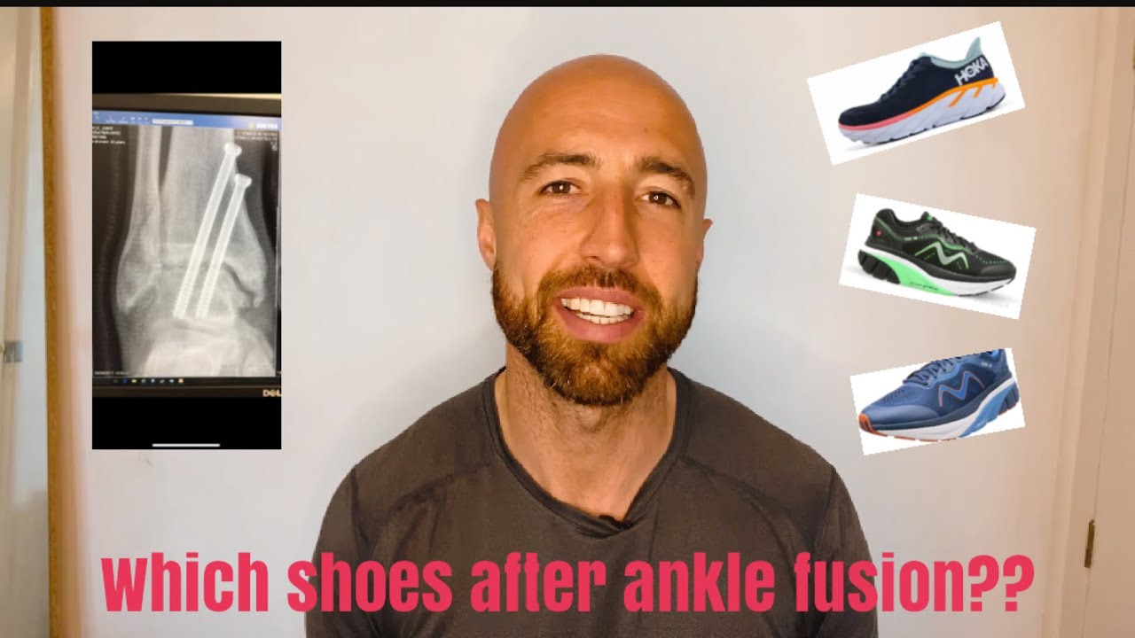 Ankle fusion - What trainers to wear after ankle fusion surgery??