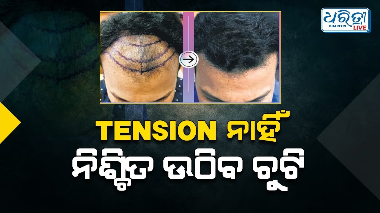 ଚୁଟି ବଢିବାରେ ସମସ୍ୟା ହେଉଛି କି? | Proven Ways For Hair Growth
