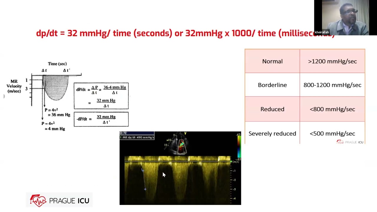 LV and RV systolic function, Dr Hatim Khirallah