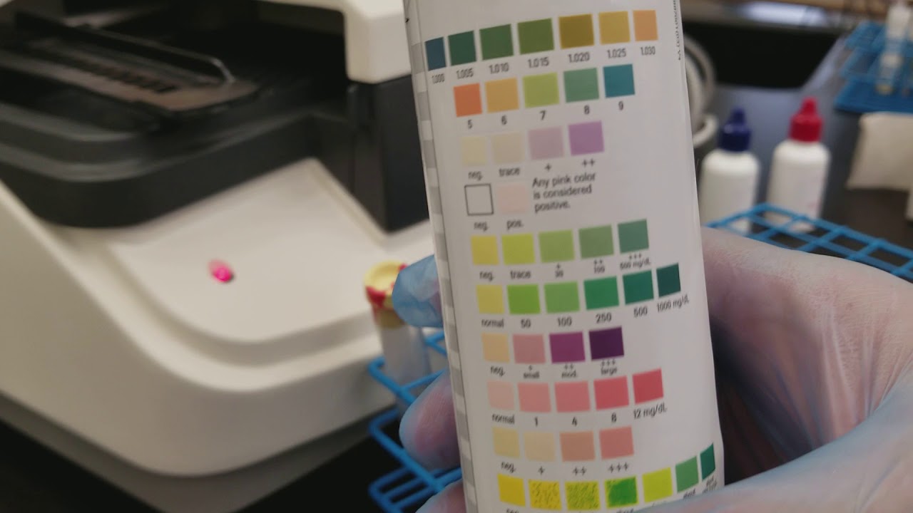 Urinalysis: Performing QC on the Criterion II