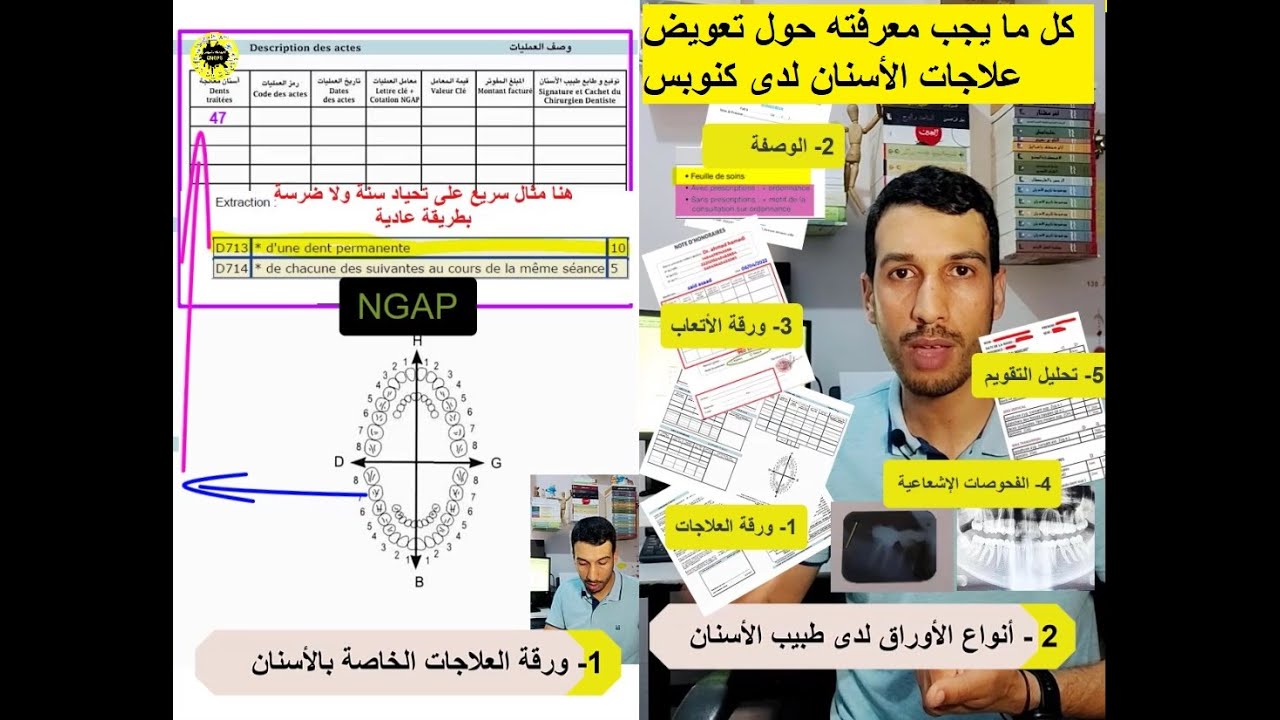 شنو كيعطيني طبيب الأسنان منين كندير عندوا زيارة ؟ radio panoramique ou rétro alvéolaire ؟