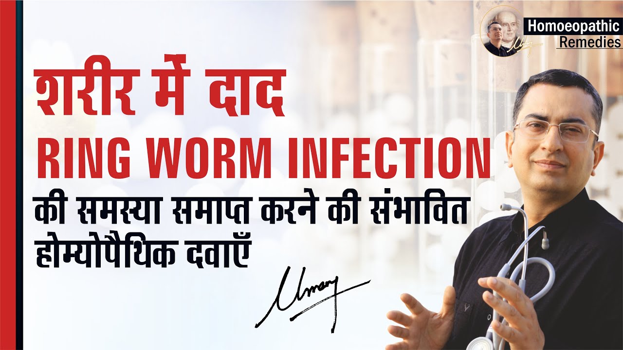 दाद | Ringworm || Natural homeopathic remedies with symptoms