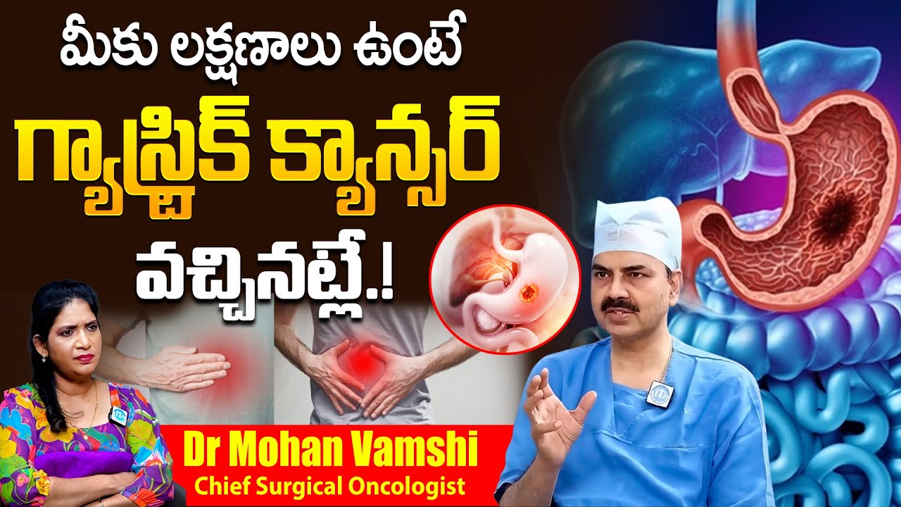 Dr Mohana Vamshy - మీకు లక్షణాలు ఉంటే గ్యాస్ట్రిక్ క్యాన్సర్ వచ్చినట్లే.! | Gastric Cancer Symptoms