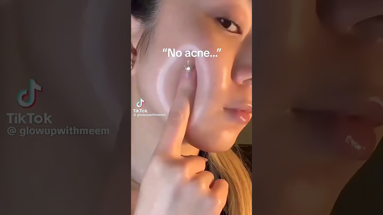 reduce acne naturally at home 🏡💕 