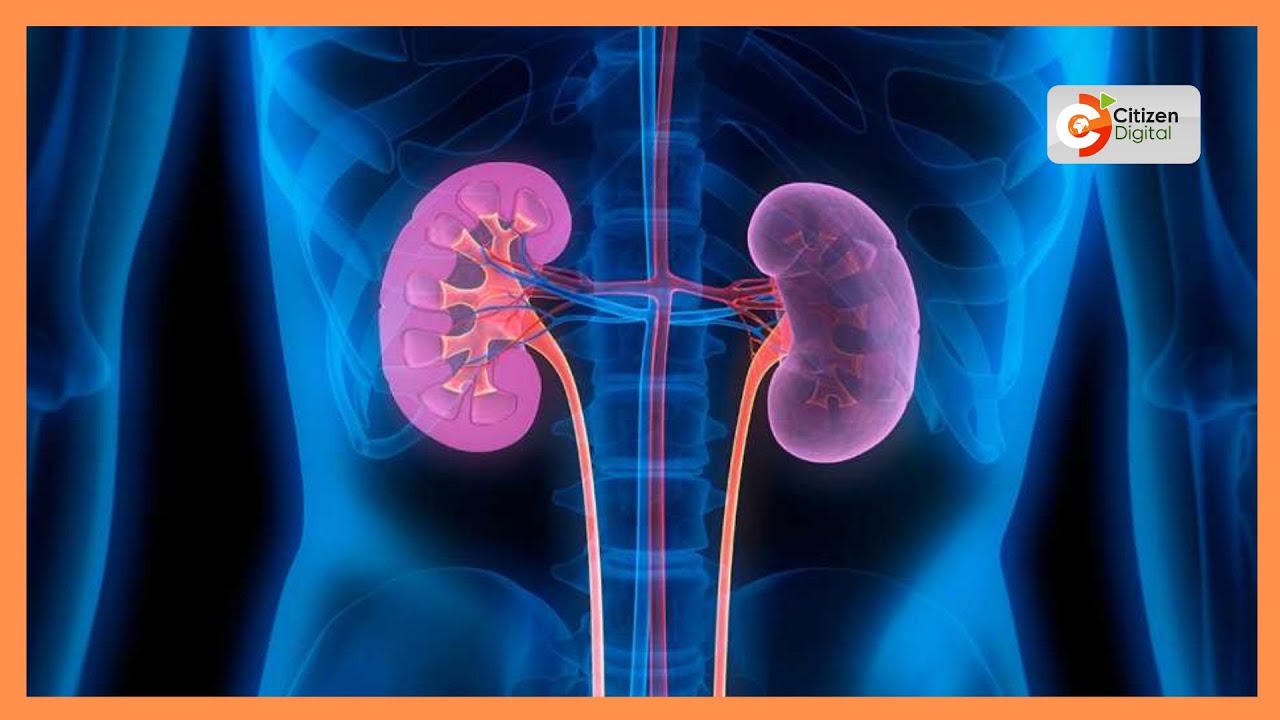 How kidney disease is straining millions of Kenyan families