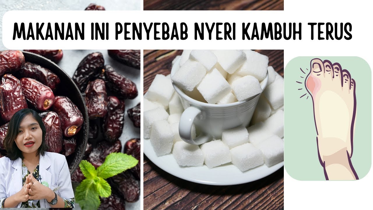 ЗАПРЕЩЕННЫЕ ПРОДУКТЫ МОЧЕВАЯ КИСЛОТА. ПРИЧИНА И РЕШЕНИЕ! | доктор Эмасуперр