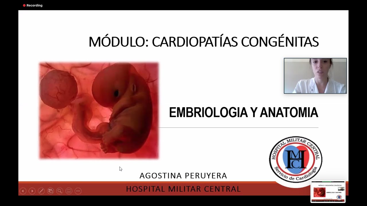 Clase de Embriología y anatomía  Parte 1 - Modulo de cardiopatías congénitas.