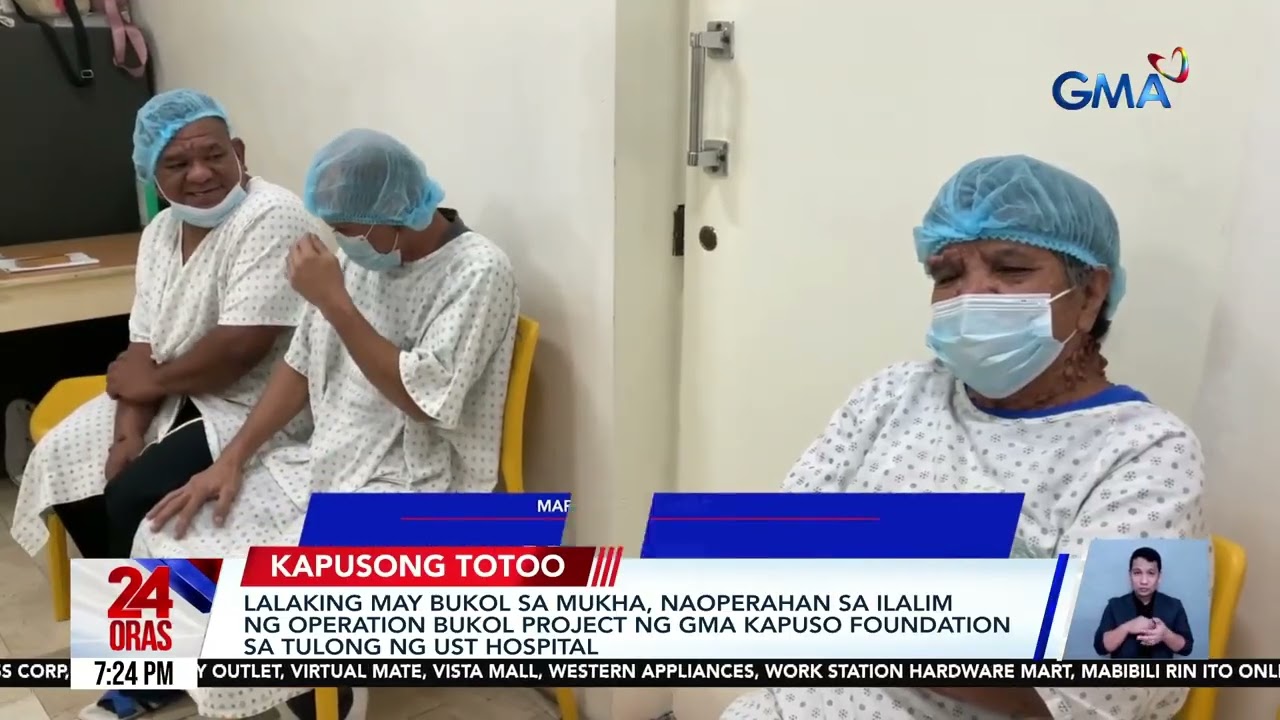 Lalaking may bukol sa mukha, naoperahan sa ilalim ng Operation Bukol Project ng GMA... | 24 Oras
