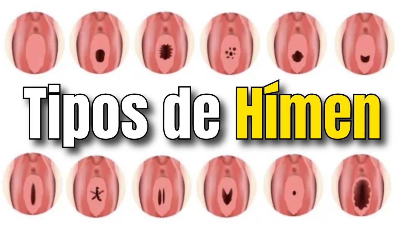 Hímen NÃO É Virgindade! Ginecologista Revela Tipos e Mitos Ocultos