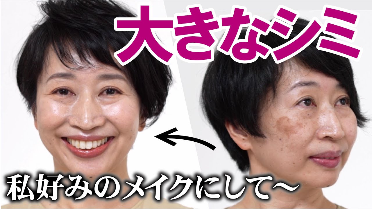 【レーザーで消したはずのシミが大きく…】私に似合うメイクが知りたいの