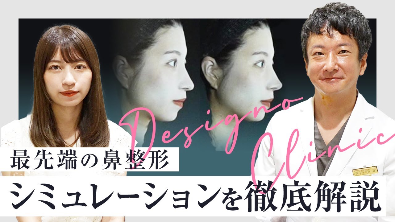 【鼻整形】【最先端】のシミュレーションを徹底解説‼️