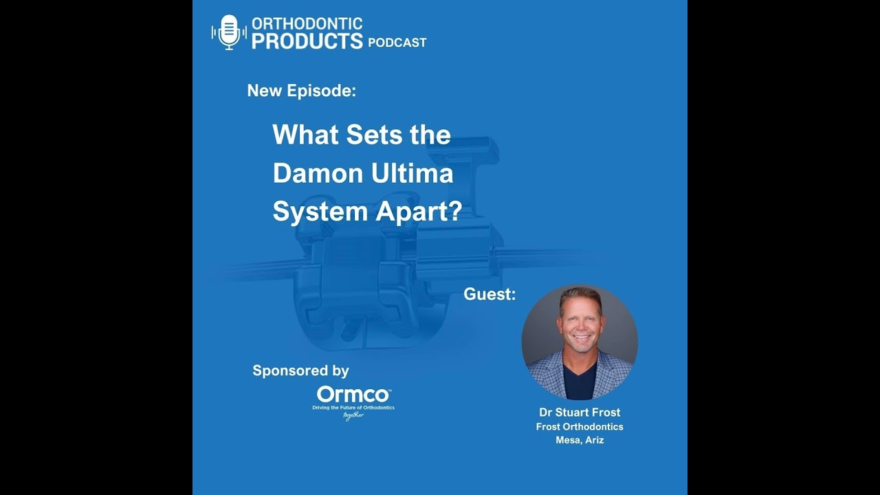 What Sets the Damon Ultima System Apart?