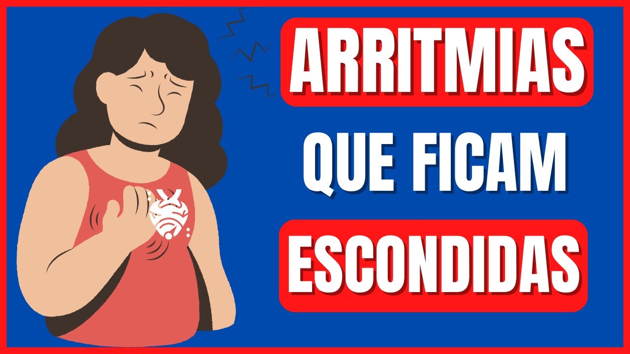 ARRITMIAS PAROXISTICAS  TAQUICARDIAS SUPRAVENTRICULARES TAQUICARDIAS VENTRICULARES DR. FELIPE SOUZA