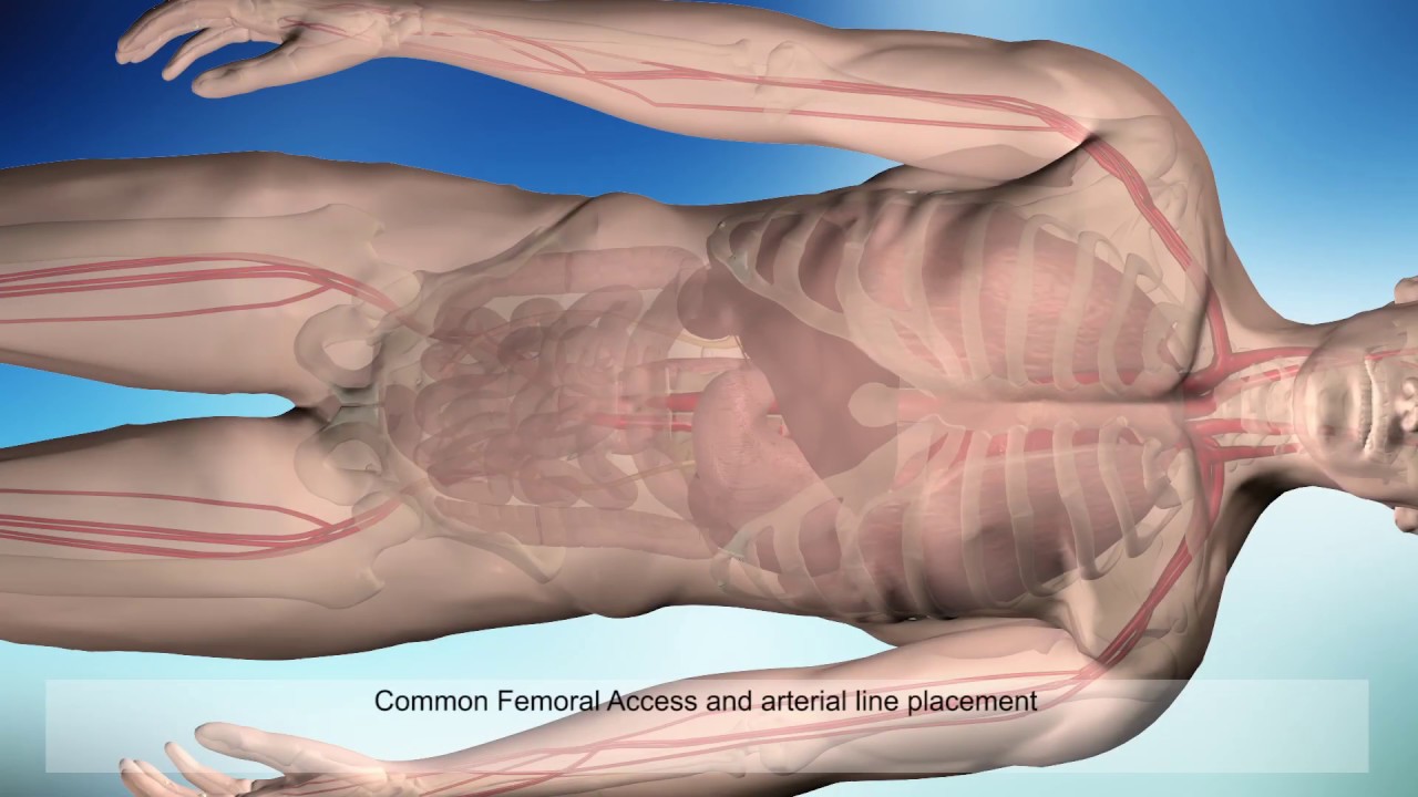 ER-REBOA&trade; Procedure