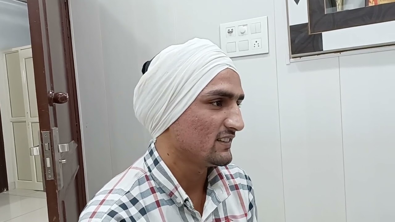 Results Acne Scars | ₹ 5000/- Acne Scar Treatment Kya Hai.