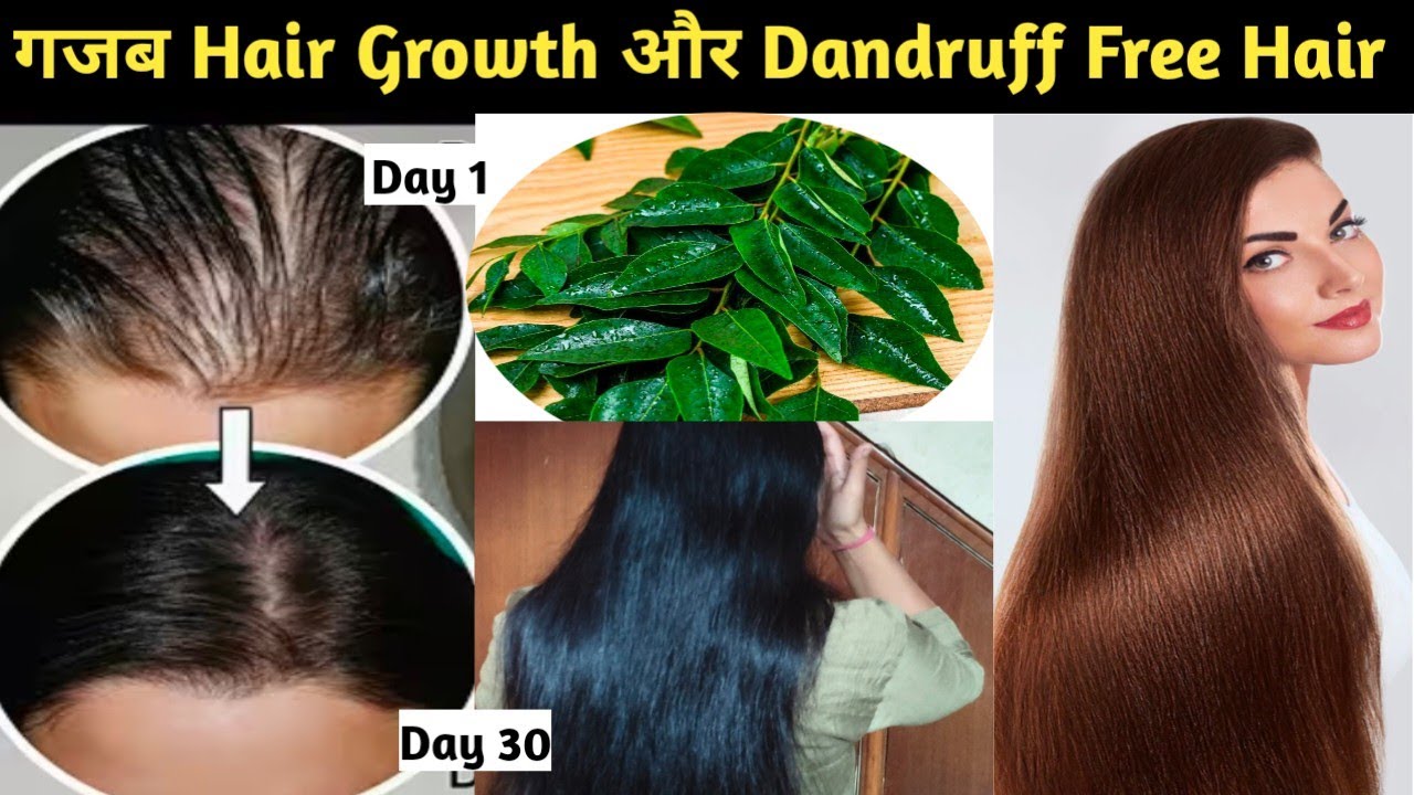 Hair Fall,Grey Hair & Thin Hair Ka Khatma|Sirf 2 Ingredients!7Din Me Hair Fall Control|GlowWithVins 