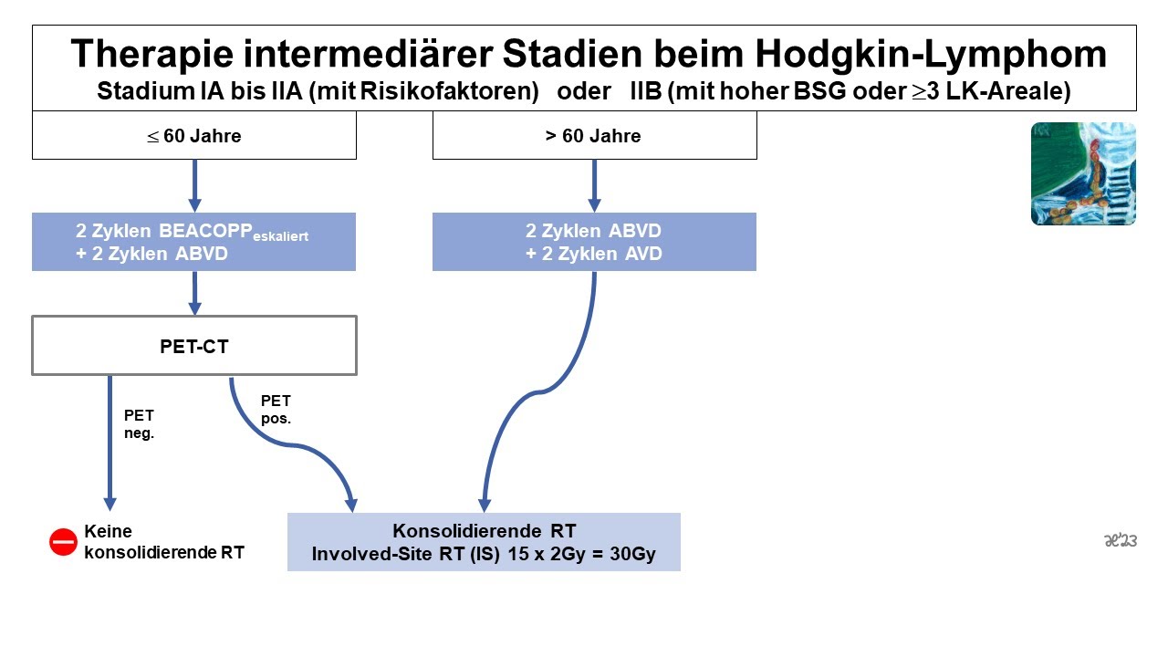 Therapie intermediären Stadien beim Hodgkin Lymphom | Strahlentherapie Prof. Hilke Vorwerk