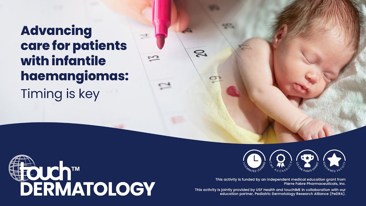 Advancing care for patients with infantile hemangioma: Timing is key