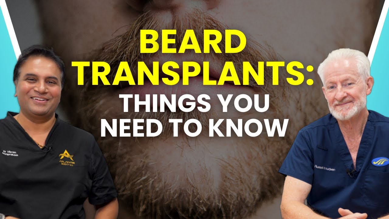 Beard Transplants Explained: What You Must Know Before Getting One