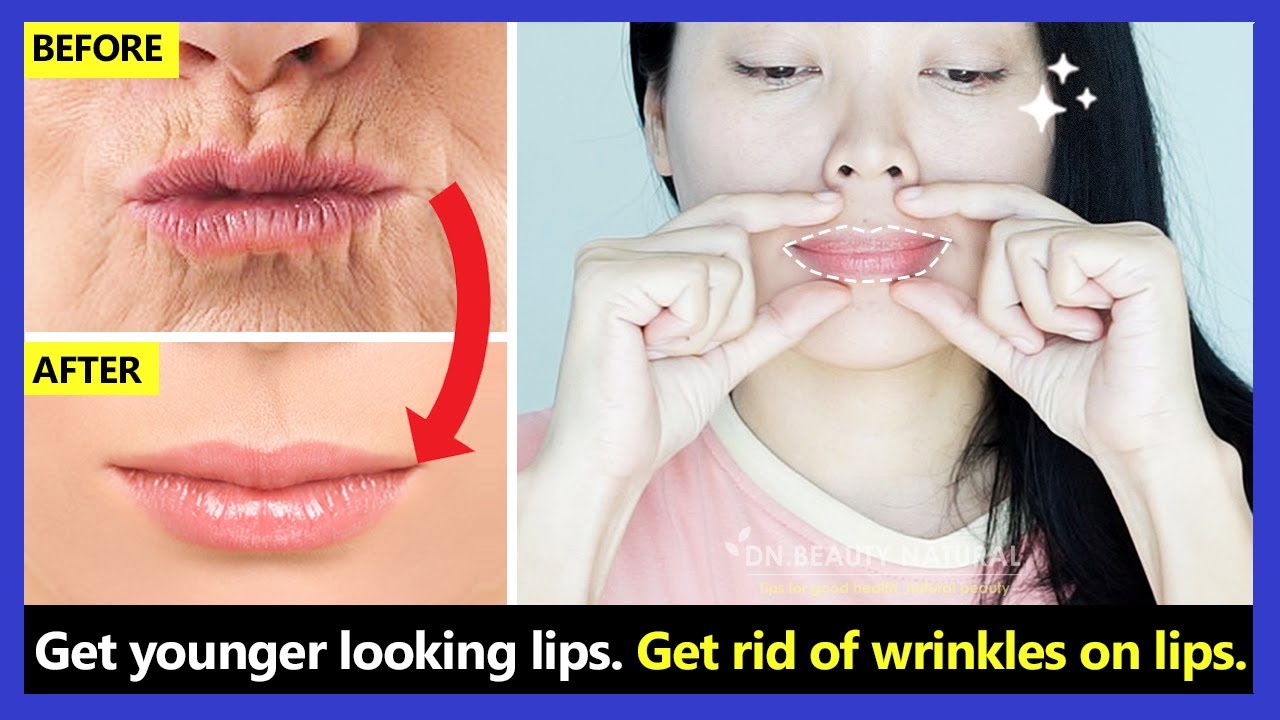 Get younger looking lips!! How to get rid of wrinkles on lips, around mouth, upper lip wrinkles.
