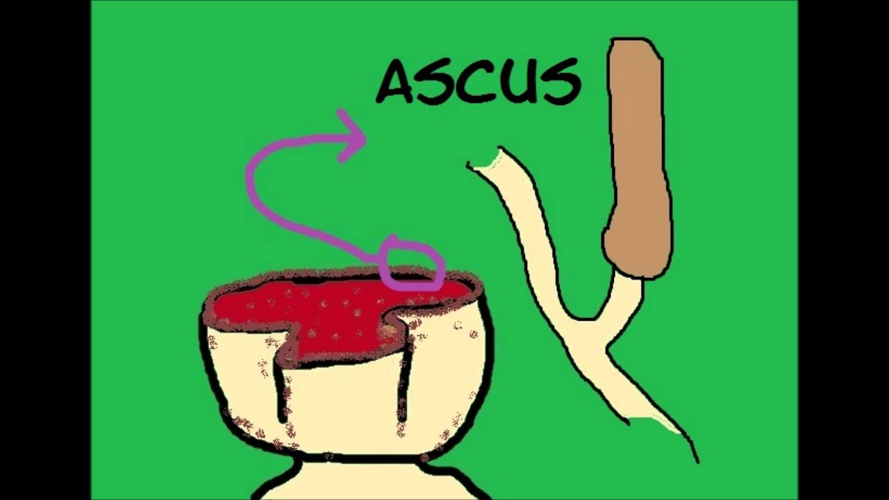Sexual Reproduction - Ascomycota