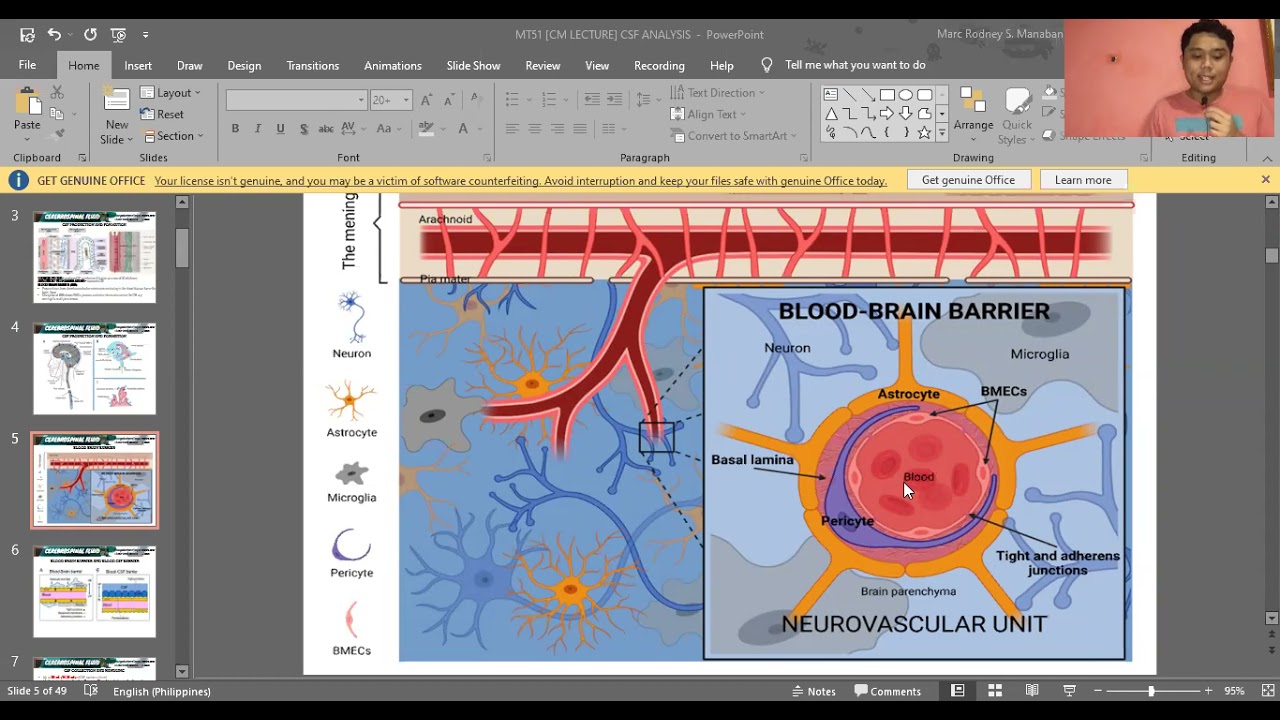 MT 51: Didactics | Clinical Microscopy Review (Cerebrospinal Fluid Analysis)
