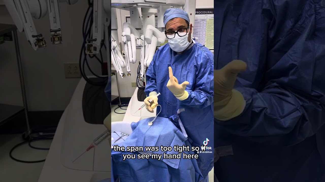 Robotic removal of Lap Band Surgery