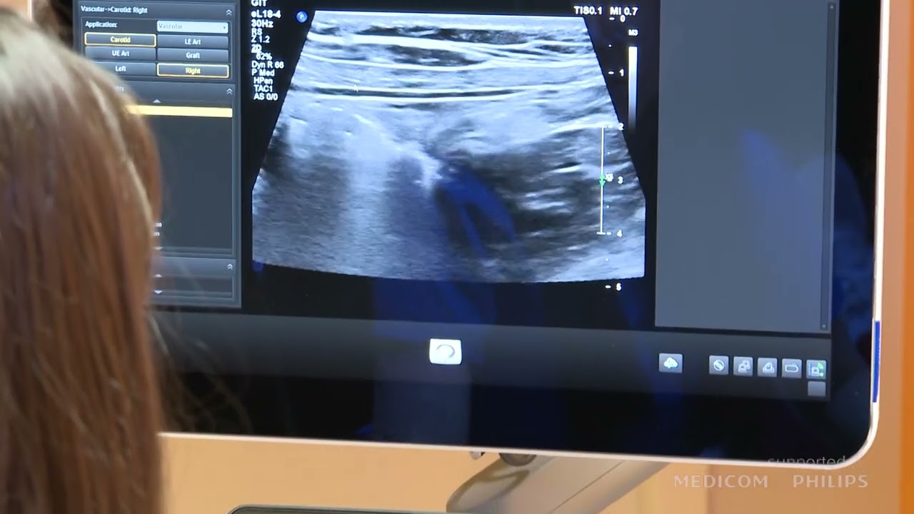 Ultrazvučni pregled digestivnog trakta - tehnika pregleda, anatomija, karakteristike zida