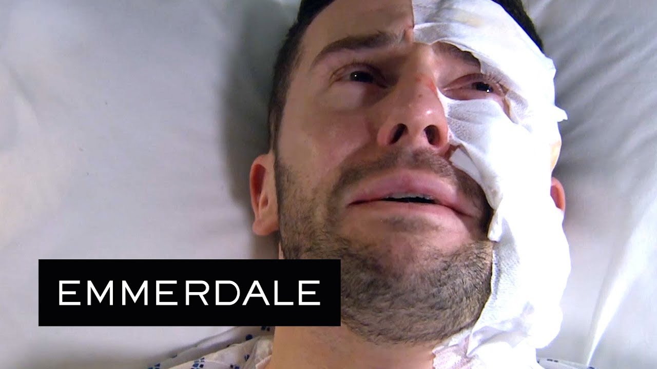 Emmerdale - Ross' Acid Burns Prognosis Brings Him to Tears
