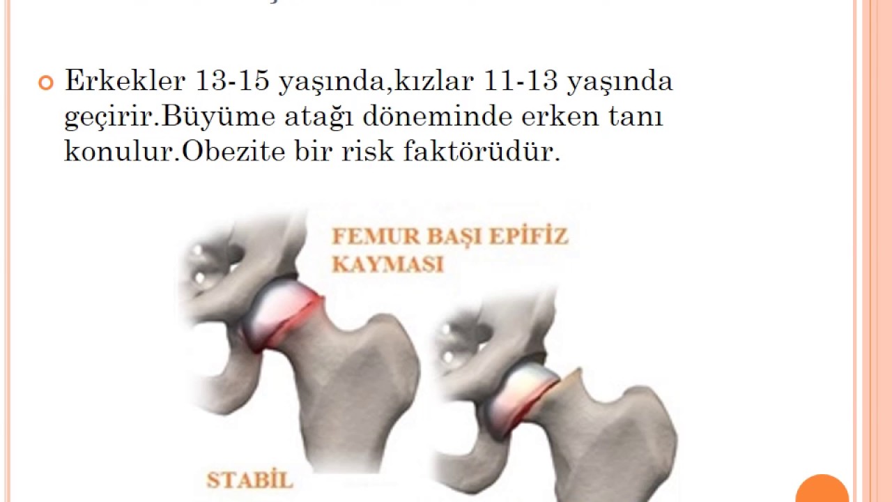 Pediatrik ortopedik aciller