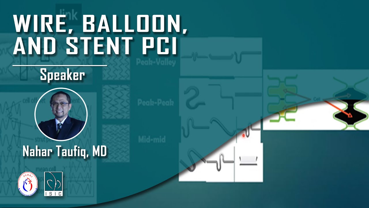 Wire, Balloon, and Stent in PCI