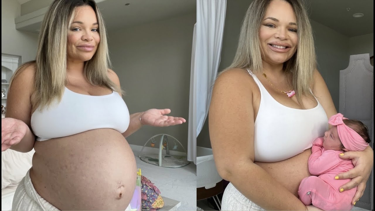 My Body 1 Week Postpartum