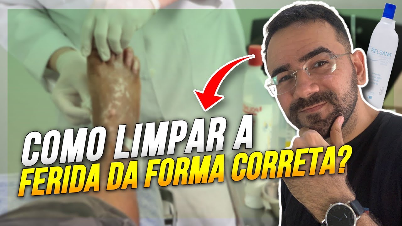 COMO LIMPAR A FERIDA DA FORMA CERTA COM PHMB (AULA PRÁTICA)