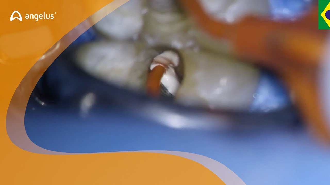BIO-C&reg; SEALER | Prof. Dr. Charles Pereira